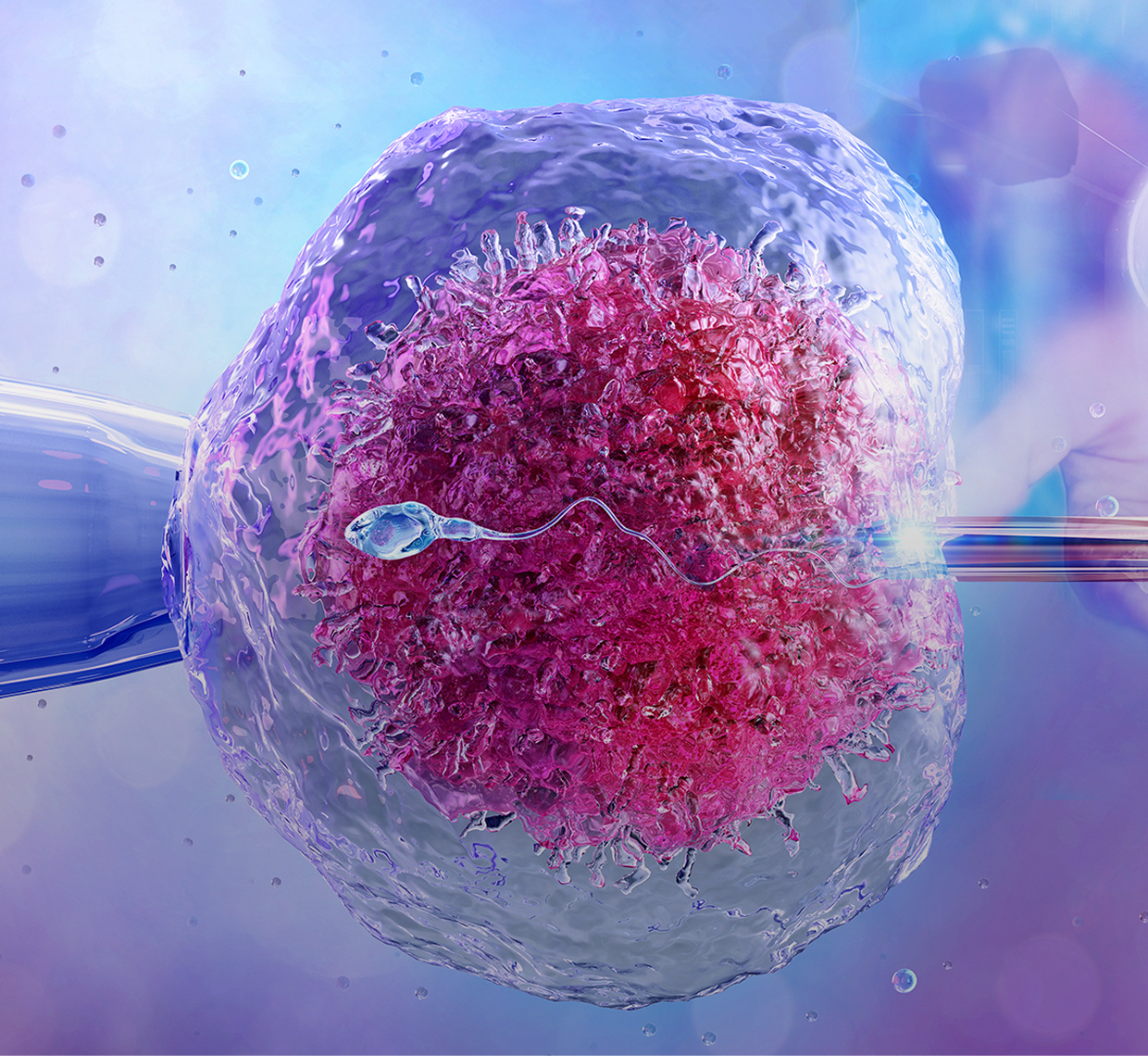 İntrasitoplazmik Sperm Enjeksiyonu (ICSI)