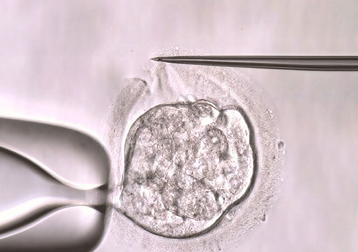 Yardımlı Yuvalanma (Assisted Hatching)